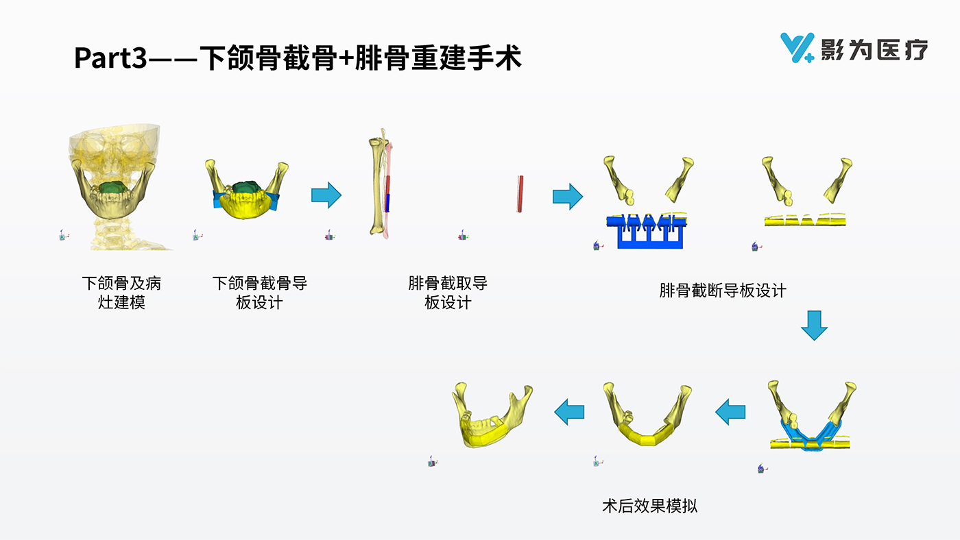 影像科3D打印解決方案