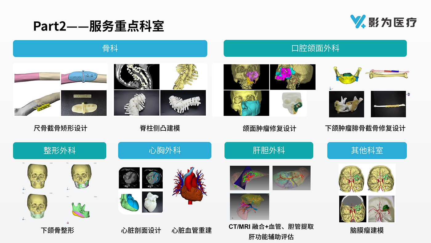 影像科3D打印解決方案