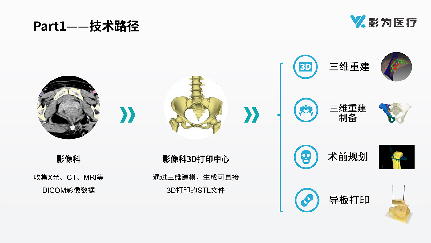 影像科3D打印解決方案